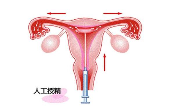 北京泰国试管婴儿中介