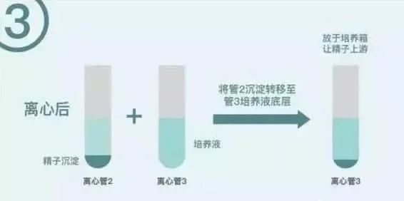 出国生二胎