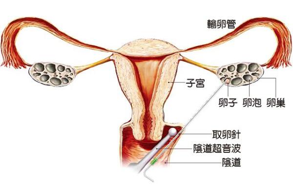 包头试管婴儿