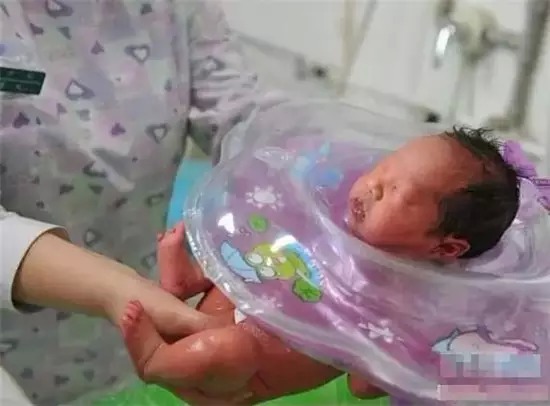 冻胚移植