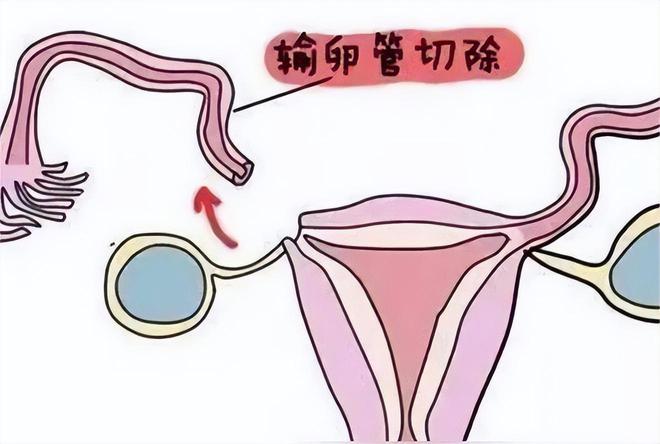 北京不孕不育