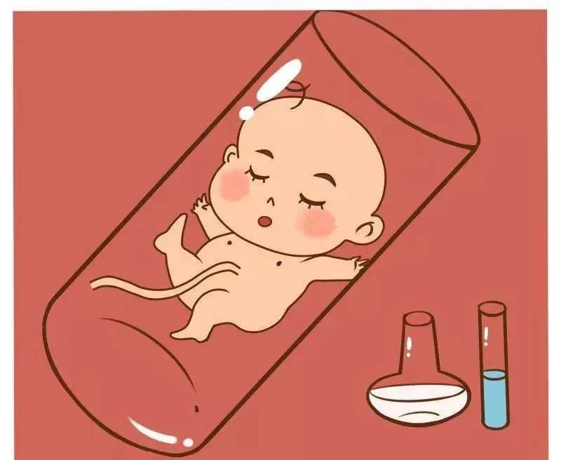 剖腹产
