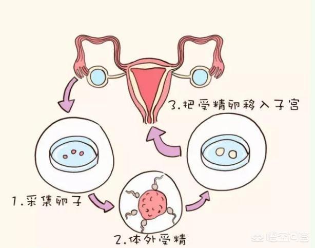 助孕医院