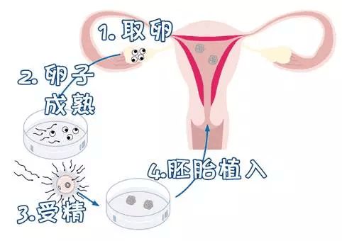 临沧捐卵补偿
