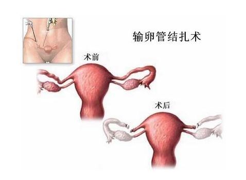 丹东高薪招聘捐卵志愿者