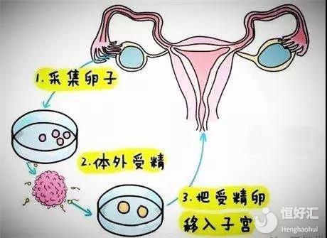 临汾高薪招聘捐卵志愿者